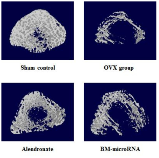 A three-dimensional tomographic rendering of a rat femur reveals the complexity of the bone structure. Images of the femoral metaphysis trabecular bone (1.5 mm thick image)