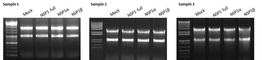 RNA sequencing을 위한 total mRNA 동정