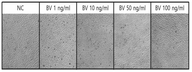 MAC-T 세포에서의 봉독 처리에 따른 세포 형태 변화(현미경 관찰)