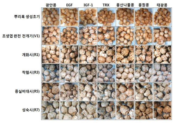 GM and non-GM soybean root nodules according to the growth stages