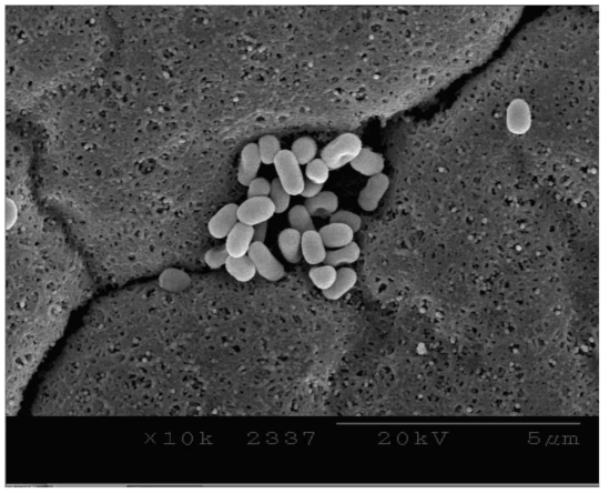 Acinetobacter sp. ZX01의 전자현미경 사진