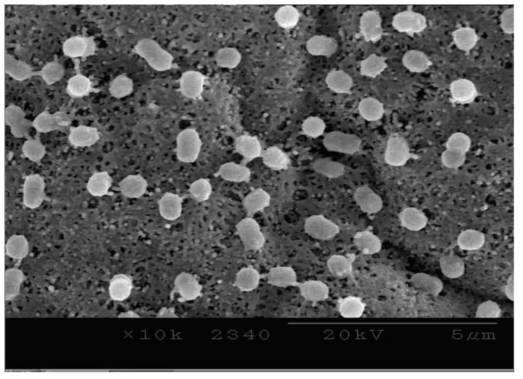 Acinetobacter sp. ZX02의 전자현미경 사진