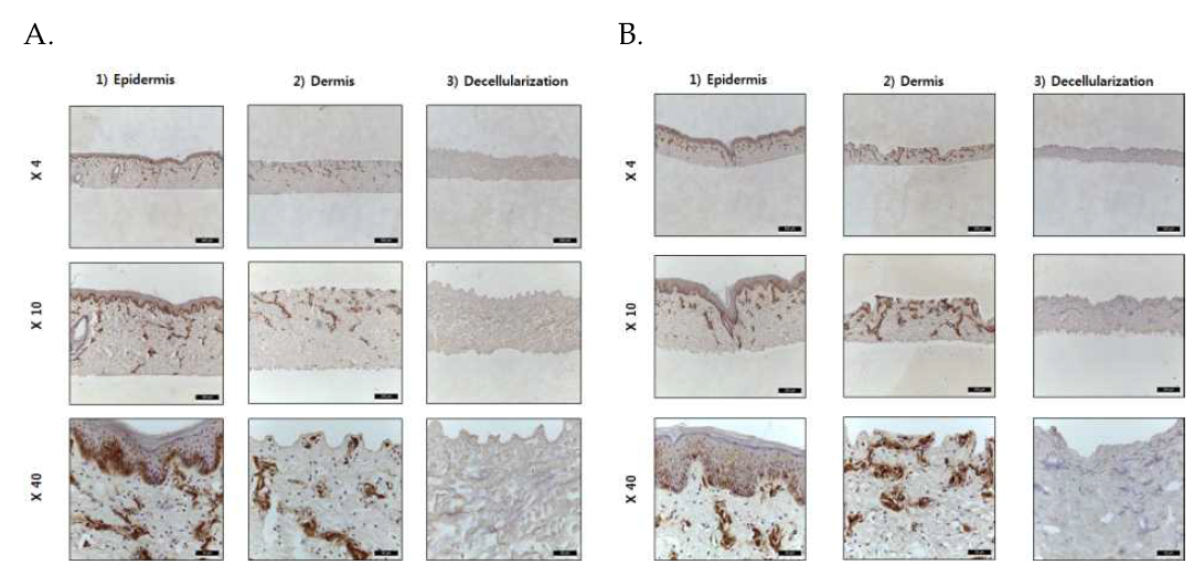 형질전환 돼지 적출 피부의 처리에 따른 MHCⅠ 발현 특성 분석 A: GT(-/-) 돼지; B: GT(-MCP/-MCP) 돼지