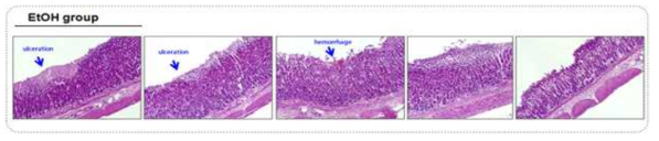 에탄올 투여 그룹의 병리학적 변화