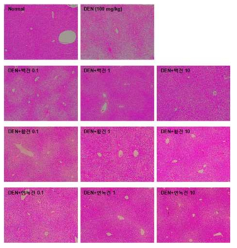 익힌 숙잠 품종별 DEN 투여 후 간 병리학적 비교 결과