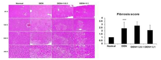 DEN 처리 12주 후 병리 사진 및 간 섬유화 결과