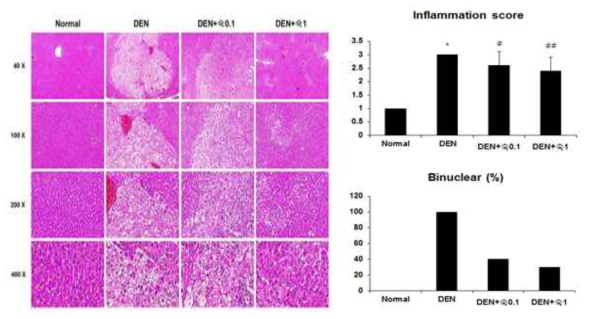 DEN 처리 16주 후 간 조직 병리학적 결과 및 암화증상에 대한 익힌 숙잠의 예방 효능