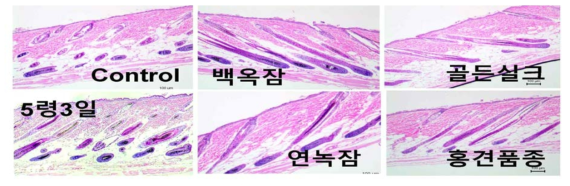 Hematoxylin & eosin 염색(피부 도포군)