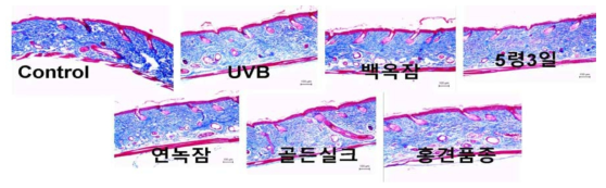 Masson’s trichrome 염색(푸른색 부분이 콜라겐 생성 부위)