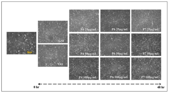 해마추출물 유래 펩타이드 (P4, P6 및 P7) 처리조건에서 성장한 C2C12 세포의 세포 형태변화 관찰. 48 시간 동안 성장 배지에서 세포모양관찰 해마 추출물유래 펩타이드들