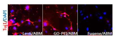Lenti vitus, GO-PEI 그리고 Fugene을 이용한 신경교차분화 후 Tuj1으로 면역염색