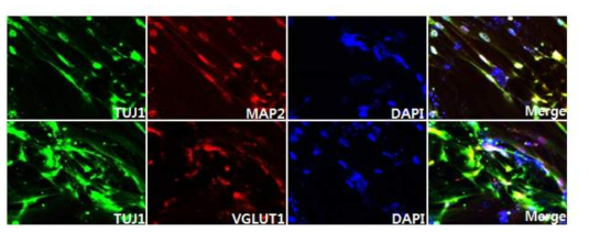 GO-PEI/ABMN을 통해 유도된 인간유도신경세포 면역염색