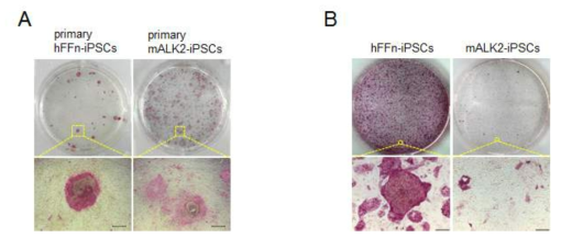 질환 체세포로부터 유래한 유도만능줄기세포에 Alkaline phosphatase 염색. primary iPSC (A), several passage를 통해 적응한 유도만능줄기세포 라인 (B). hFFn 정상 체세포 유래 유도만능줄기세포, mALK2 환자 유래 유도만능줄기세포