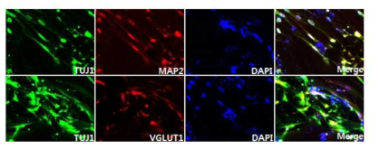 GO-PEI/ABMN을 통해 유도된 인간유도신경세포 면역염색