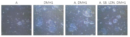 Addition of DMH1 greatly increases reprogramming efficiency and kinetics on day 12