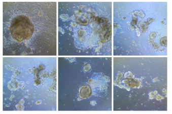 Isolated colonies from #151 experiment did not attach