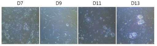 Morphology change during reprogramming under SKL2001 added condition