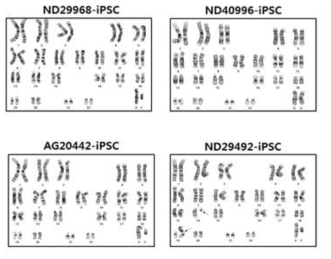 Karyotype analysis of PD-iPSCs