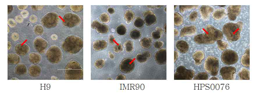 Formation of neural rosette during NES culture