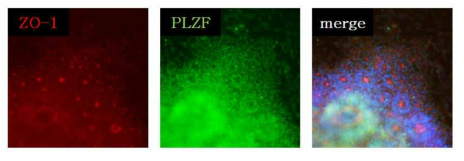 Expression of neural rosette markers