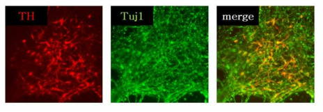 Differentiated neurons have expressed TH and TUJ1