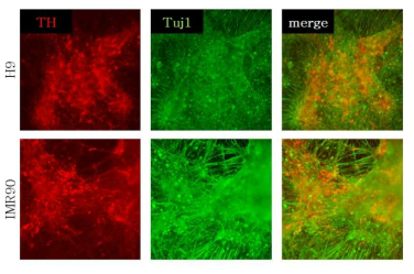 Expression of dopaminergic neuron marker using new method