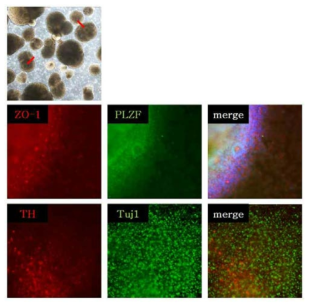 Differentiation of LRRK2(G2019S)-iPSC to dopaminergic neuron