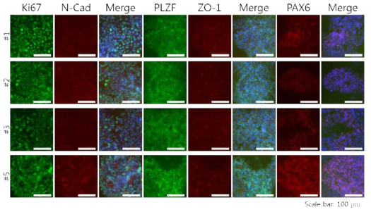 Charaterization of SiNSCs under proliferation condition