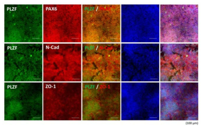 ICC for PLZF, PAX6, N-CADHERIN, and ZO-1 in ND29968-iNSC