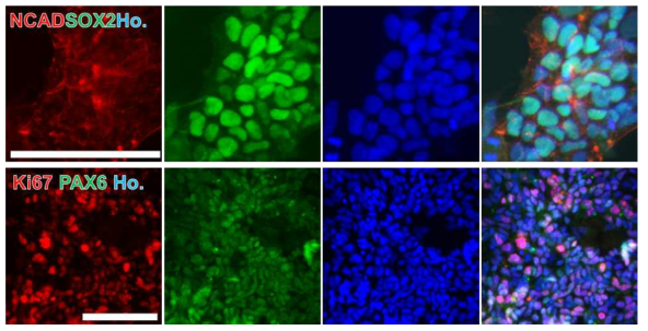 ICC for neural markers in LRRK2-iNSCs