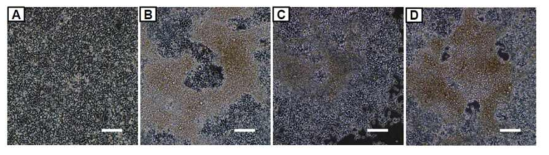 Production of Adenovirus with hSTEMCCA in 293T cell