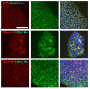 Characterization of CD-iPSCs. ICC for pluripotency markers under proliferation condition