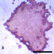 AP staining of CD-iPSCs