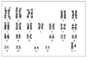 Karyotype analysis of CD-iPSCs