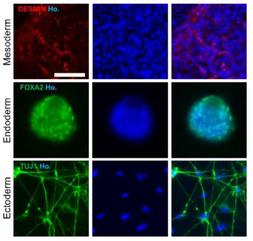 In vitro differentiation potential was confirmed by ICC for three-germ layer markers. CD-iPSCs were differentiated spontaneously