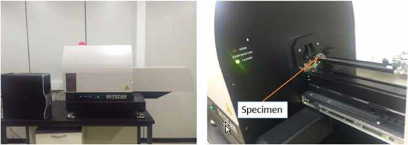 CT-Scan (model - SkyScan - 1076)