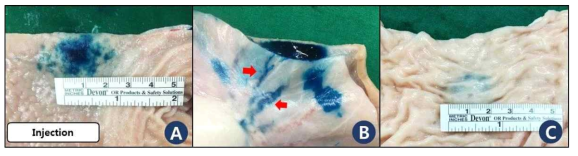 Immediate finding after indigo carmine tattooing. The lesion can be identified easily with well-stained deep blue color. A: Gastric serosa surface. B: Gastric mucosal surface. Some stained lymphatics and vessles are observed. (red arrow) C: Colonic serosal surface