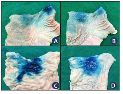 Serosal surface of stomach and colon at 1 day and 5 day after indigo carmine tattooing. A: Gastric serosa. (1 day) Blue color became pale due to washing out. B: Gastric serosa. (5 day) Coloring area became wider. C: Colonic serosa. (1 day) The color became much thicker. D: Colonic serosa. (5 day) Blue color wash out more compared with color at 1 day. It may means that a lot of diffusion or spreading of dye has occurred within short duration