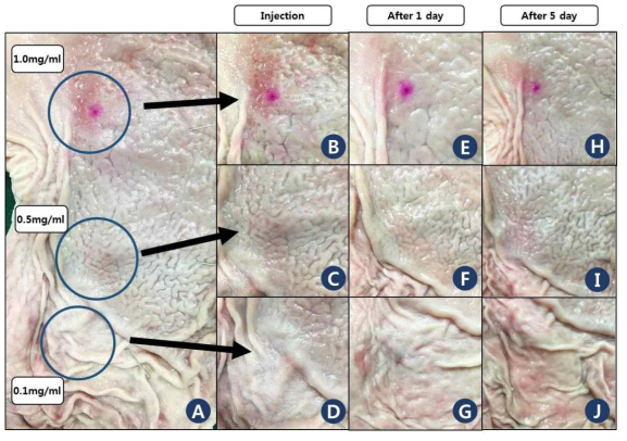 Gastric serosa after HBP-Rh injection in the submucosa layer. 2ml HBP-Rh was injected at each site respectively. A: Gastric serosa overview. B, C, D: Details of each site at immediate injection. E, F, G: Change of color expression at 1 day after injection. H, I,J: Details of each site at 5 day after injection. Dye spreading and diffusion were minimized at 1mg/ml, however, it was difficult to identify the location of injection site at 0.5mg/ml and 0.1mg/ml