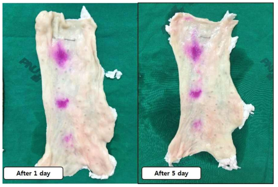 Serosal surface of colon at 1 day and 5 days after HBP-Rh injection. Dye spreading and diffusion was rare. At 1mg/ml, area of coloring was expanded a little. A: at 1 day after injection, B: at 5 day after injection