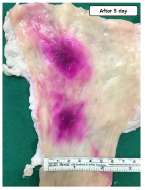 Colonic serosal surface at 5 day after injection of the high concentrated HBP-Rh. The dark-pink color was well expressed and not much spread and widen around the tissue
