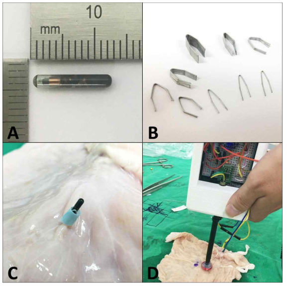Lesion localization using the RFID tag. A) Low-frequency cylindrical RFID tag (passive, 125 kHz). B) Modified metal clips. C) Application of clip and RFID tag to the mucosal surface of the stomach. D) Localization of RFID tag using the wireless detector. RFID; radio-frequency identification