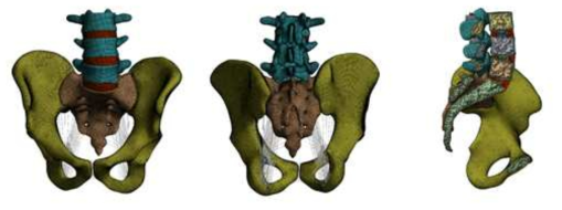 추간판 및 각종 인대가 삽입된 척추골반의 유한요소모델 : 전방 (좌), 후방 (중), 단면 (우)