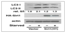 LC3-II로의 전환 확인을 통한 오토파지 활성 검증 실험
