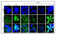 FK506 처리로 인한 핵으로의 TFEB 이동 증가 검증