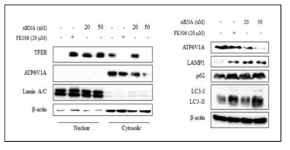 FK506 처리 및 표적단백질(V-ATPase) knock down으로 인한 핵으로의 TFEB 이동 및 오토파지 유도 활성 검증