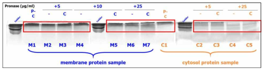 LC-MS/MS 단백체 분석을 위한 In gel digestion 조건 설립