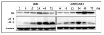 진피섬유아세포에서 인삼의 유효성분(R)의 오토파지 유도활성 결과