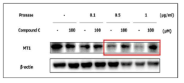 MT1의 pronase 처리 농도별 제한적 단백질 분해법 실험 결과
