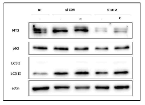 MT2의 siRNA knock down을 이용한 오토파지 활성 변화 실험 결과